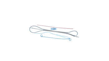 Urethral Indwelling Double Pigtail Stent Set